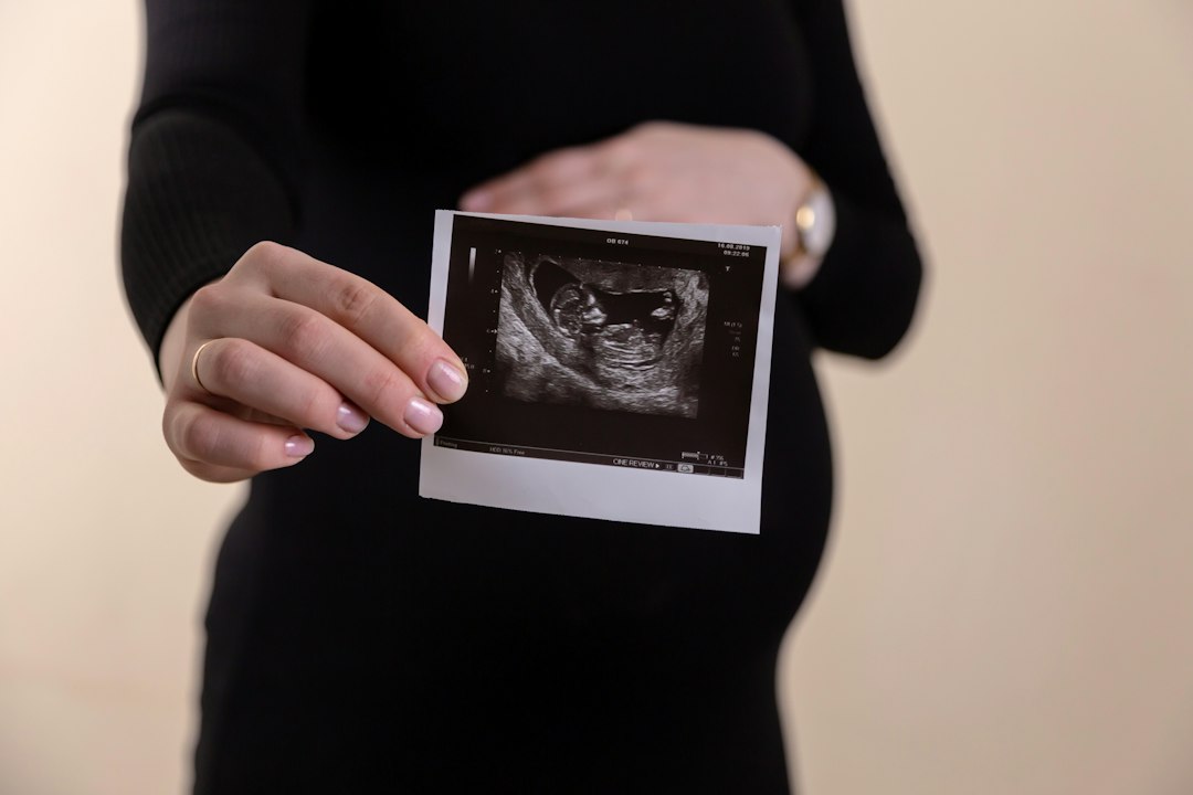 IVF Follicle Monitoring During Ovulation Induction