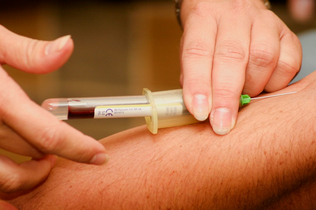 Understanding Immunological Infertility: Essential Tests and Treatment