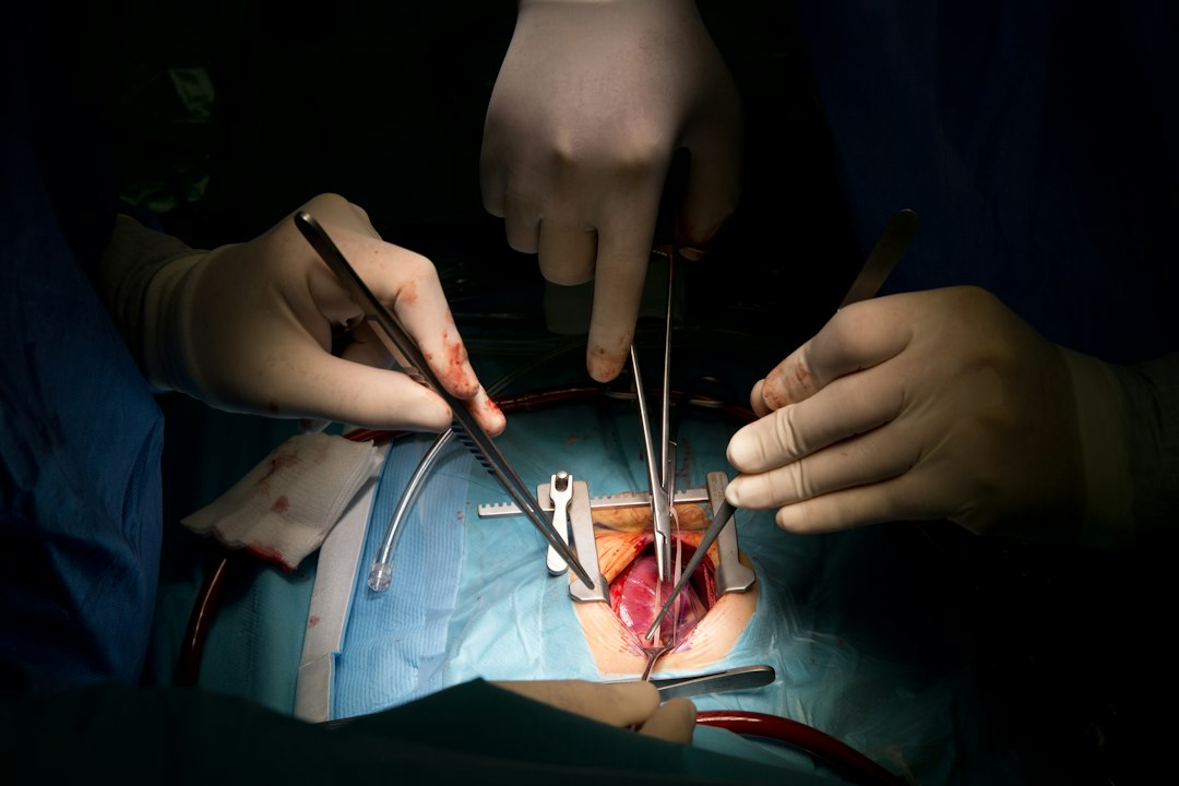 Uterine Fibroids and IVF: Do I Need Surgery First?